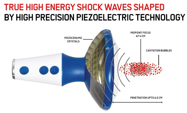 DolorClast-Focused-Shockwaves-Handpiece2 DolorClast-Focused-Shockwaves-Handpiece2